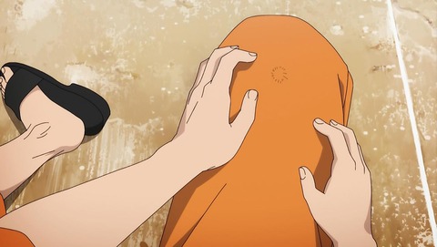 ancb00113