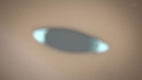 ancb03158