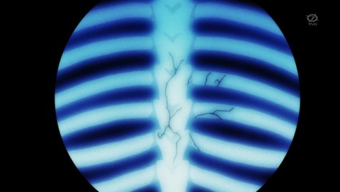ANCB001615