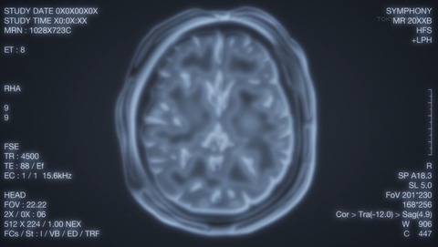 ancb001373