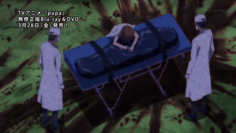 ancb00172