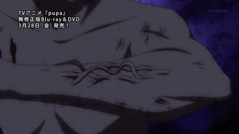 ancb00212