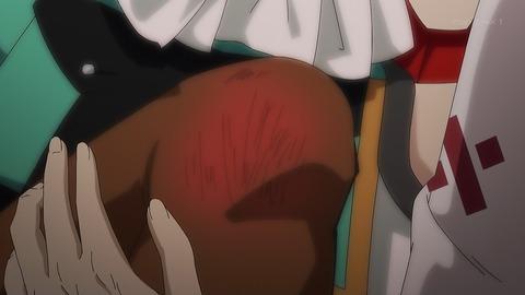 ancb00131
