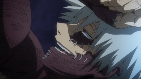 ancb00314
