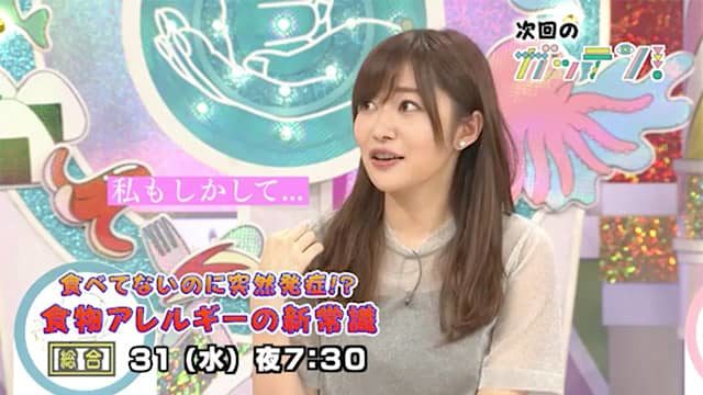 「ガッテン！」食べてないのに突然発症！？食物アレルギーの新常識 ＊ 出演：指原莉乃（HKT48） [1月/31 19:30～]