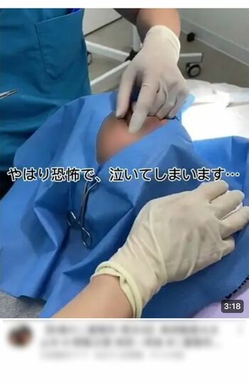 泣き叫ぶ9歳娘に二重まぶた整形…母「おち〇ち〇剥くのも美容整形も、しない方が虐待です!」