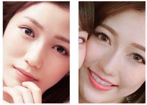 【整形モンスター】渡辺麻友が目頭切開、鼻を整形し大炎上