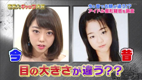 【AKB48G】メンバーが整形してたとして叩く意味が全くわからない