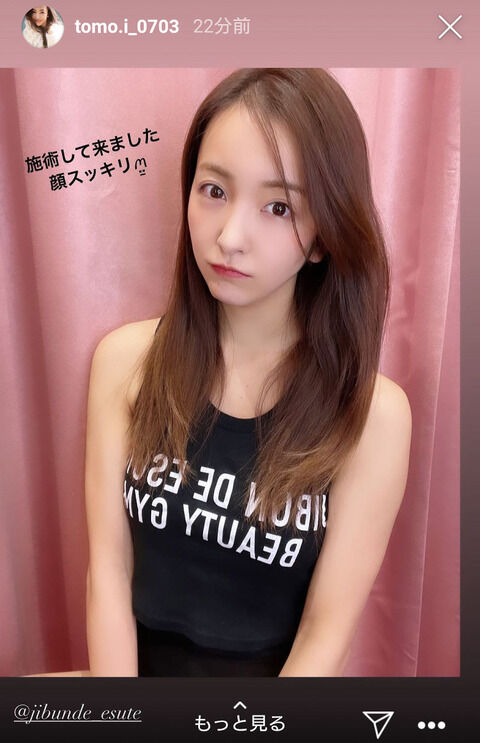 板野友美、改造手術後のスッキリ顔＆ノースリーブ姿を公開「スタイルいい」「ずっと憧れ」「ケーキ倒すな」