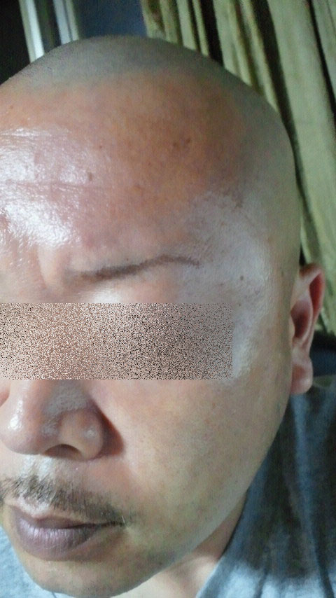 ご提案 Today Skin ご提案 Today Skin