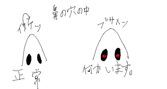 85