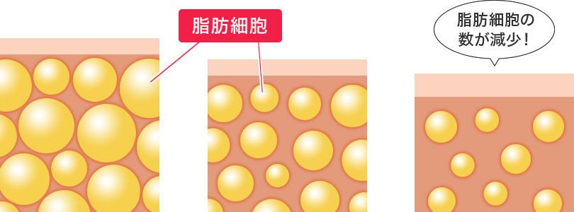 脂肪 細胞 減らす 中性脂肪を増やす食べ物 減らす食べ物 Amp Petmd Com 脂肪 細胞 減らす 中性脂肪を増やす食べ物 減らす食べ物 Amp Petmd Com