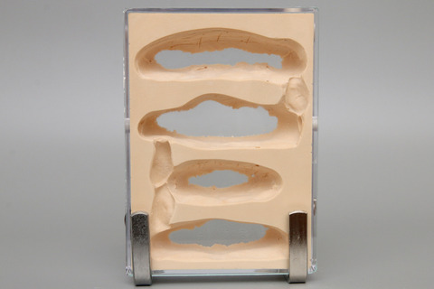 �ߥĥĥܥ���