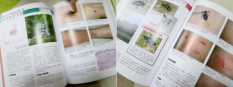 入荷日 「Dr.夏秋の臨床図鑑 虫と皮膚炎」 健康/医学 dr-julien-mailly