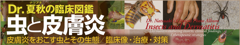 Dr.夏秋の臨床図鑑 虫と皮膚炎 | 夏秋優 |本 | 通販 | Amazon