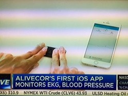 EKG