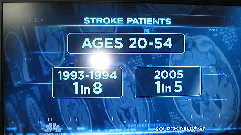 Stroke01