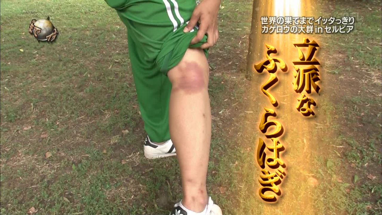 画像 森山あすかとかいう日本一可愛いお笑い芸人wwwwwww 青速まとめ 画像 森山あすかとかいう日本一可愛いお笑い芸人wwwwwww 青速まとめ