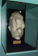 Tertiary_syphilis_head