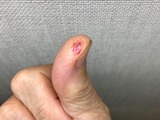 (5) 怪我