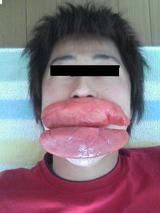 唇星人