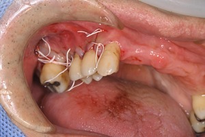DSC_0414