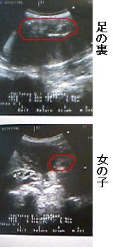 32w3d 健診 ももログ