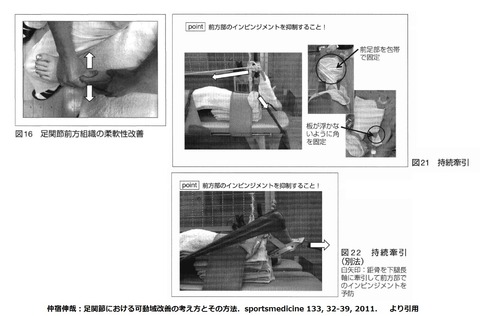 前方組織治療方法