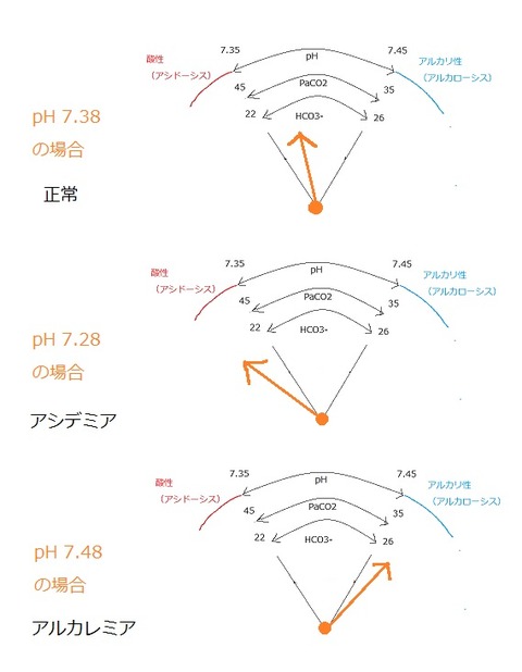 血液ガスの見方　pH