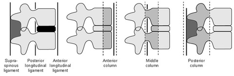 Three Column Theory