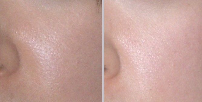 整体による美肌 美白効果 肌の若返り からだのみかた 整体による美肌 美白効果 肌の若返り からだのみかた