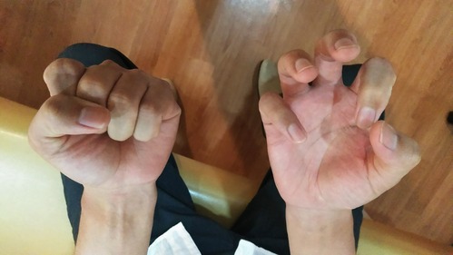 え マジ 力強く手で拳を握りしめることが出来ないと困る あらた整骨院の元気が出るブログ え マジ 力強く手で拳を握りしめることが出来ないと困る あらた整骨院の元気が出るブログ