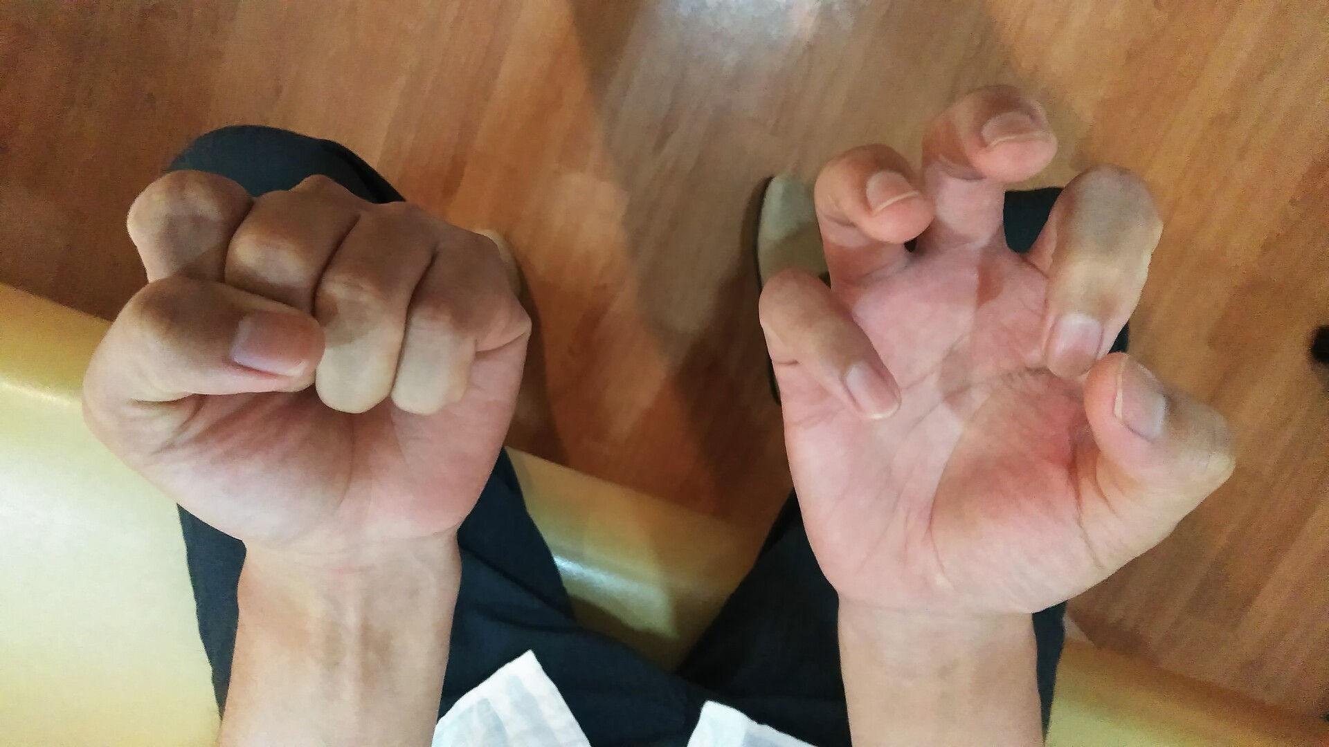 え マジ 力強く手で拳を握りしめることが出来ないと困る あらた整骨院の元気が出るブログ え マジ 力強く手で拳を握りしめることが出来ないと困る あらた整骨院の元気が出るブログ