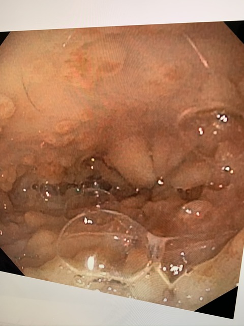 131D00D0-529A-4481-855D-EC8535BB4117