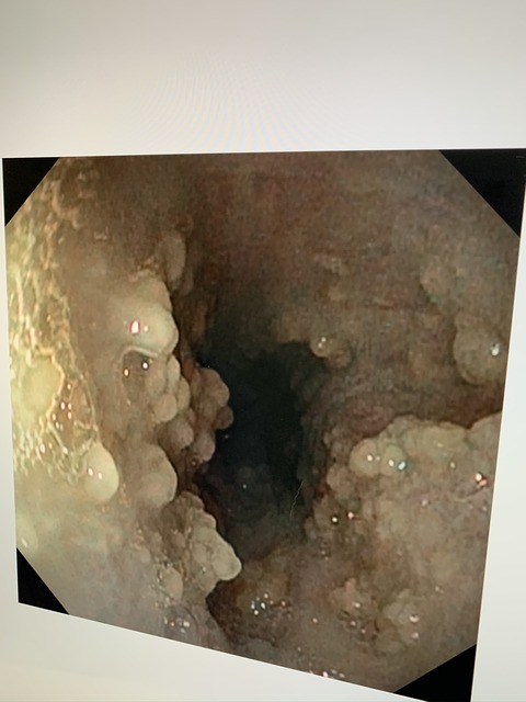 ED24E943-EC3E-4F40-8065-B56AC15D9680