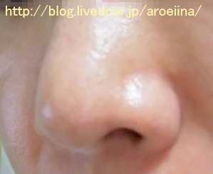 鼻の角栓 ビオレ おうちdeエステ マッサージ洗顔ジェルの口コミ 毛穴詰まり アロエの気になる事 口コミブログ