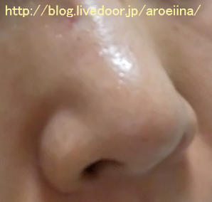 鼻の角栓 ビオレ おうちdeエステ マッサージ洗顔ジェルの口コミ 毛穴詰まり アロエの気になる事 口コミブログ