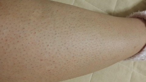 B 超衝撃 超剛毛女の私の半生を語る 衝撃画像あり 肌速 B 超衝撃 超剛毛女の私の半生を語る 衝撃画像あり 肌速