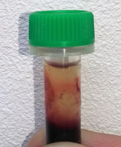 自己免疫性溶血性貧血_犬2