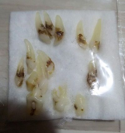 イタグレこまり抜歯3