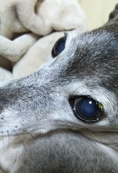 アル_白内障進行防止5