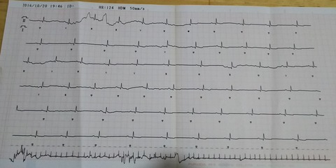 ジェイ_健康診断8