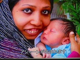 難病奇病のエクストリーム ボディを背負った人たち 徒然 あさやんの史記と四季