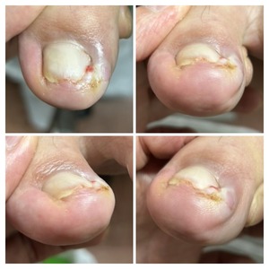 77D57018-33C1-4015-982D-5444D1A49289-COLLAGE