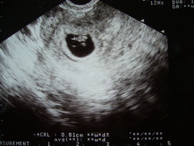 7w1d 心拍確認 やまっぷのくるるん 日記