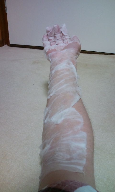 アトピー闘病記録