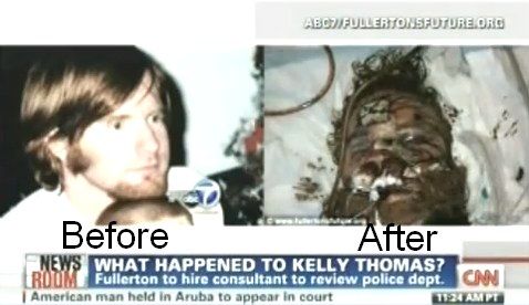 Kelly-Thomas-Beating-Before-And-After