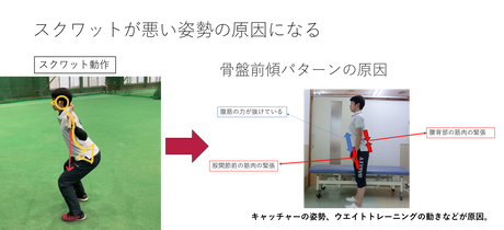 スクワットが悪い姿勢の原因になる