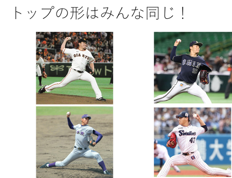 トップの形