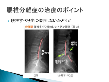 治療のポイント